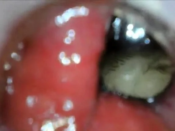 anal endoscope ass play from inside