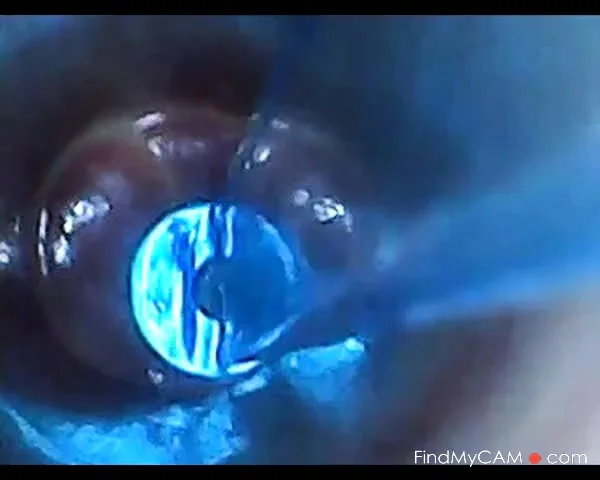 test tube cock endoscope POV urethral insertion ball rod