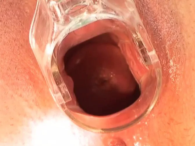 Viona pees outside and goes in to toy her twat and use a speculum
