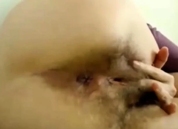 One of the most hairy asshole in the world