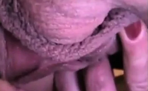 Thought I'd Seen it All: Amateur Close-Up Webcam Edition