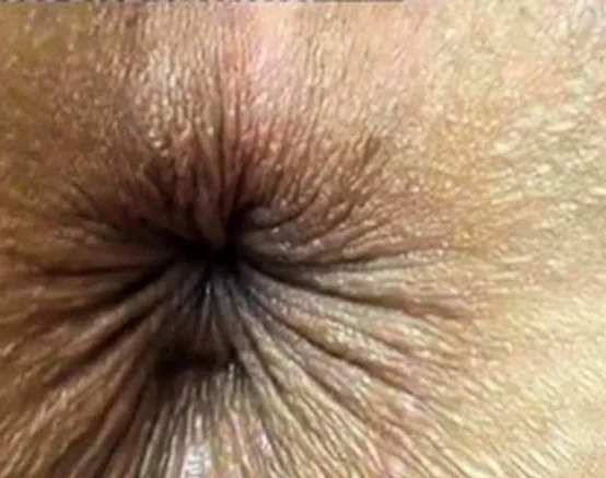 Winking Butthole Close-Up on Webcam