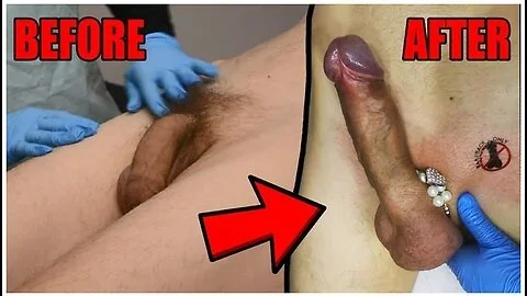 Dick Wax Depilation By Cute Esthetician. Before And After