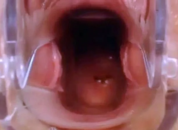 Webcam Pussy Play with Speculum