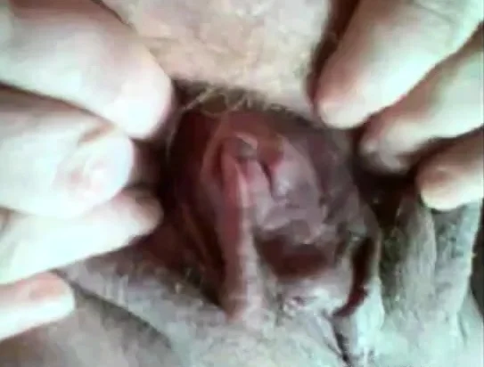 another gyno cam with my good aunty