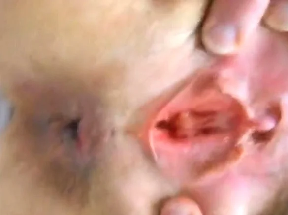 Hairy Mature