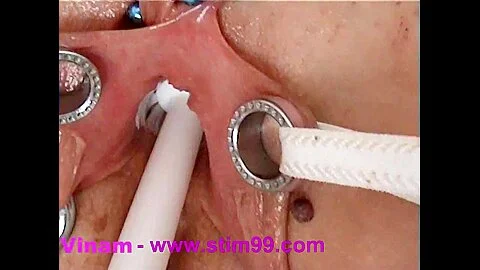 Extreme Anal Fisting, Huge Objects, Cervix Insertion, Peehole Fucking, Nettles, Electro Orgasms and Saline Injection Vintage Porn