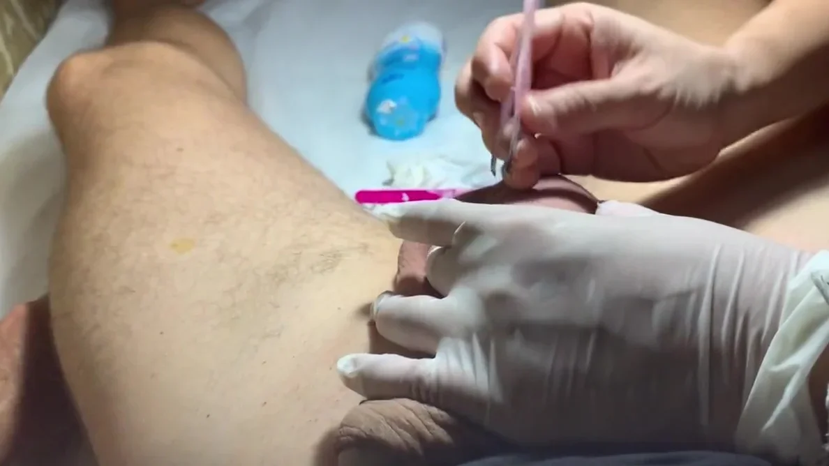 Brazilian Wax for a Big Floppy Dick 4 Wax and Tweez