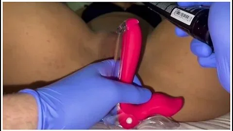 Pussy Care Gynecologist Speculum Examination Brought Me To Orgasm Fluid Examination