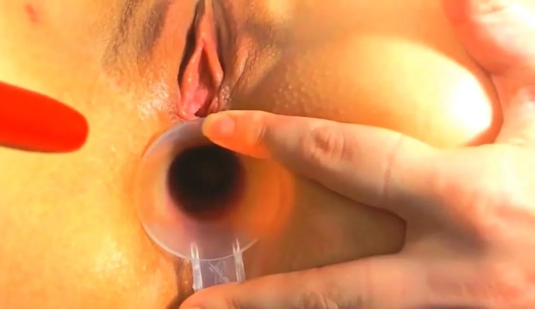 German Blone Babe Doktorspiele 2